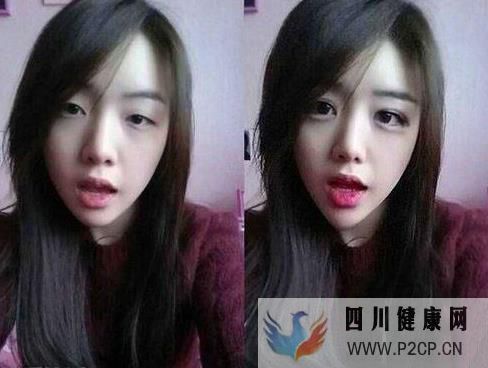 美容整形前一定要知道的美容整形知识(图4) 美容整形前一定要知道的美容整形知识(图4)