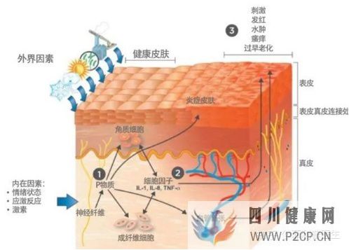 皮肤过敏,从原因到解决方案(图13)