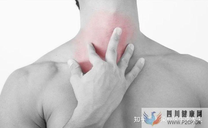 如果不幸感染“艾滋”,身体会有哪些症状(图6) 如果不幸感染“艾滋”,身体会有哪些症状(图6)