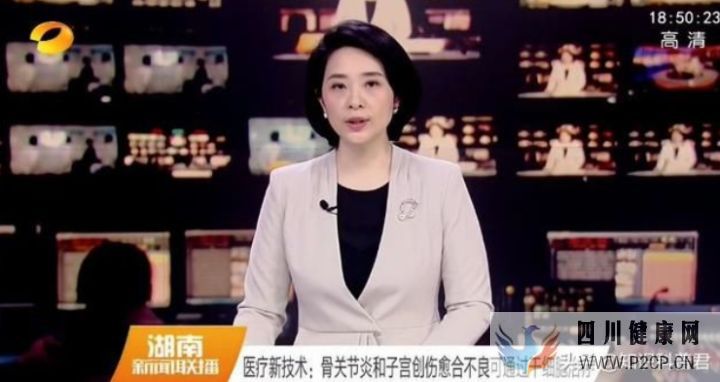 快讯干细胞治疗骨关节炎最新临床数据安全且有效(图4)