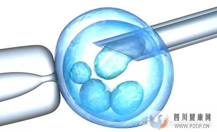 干细胞知多少回输选第几代多久见效自体还是异...(图3) 干细胞知多少回输选第几代多久见效自体还是异...(图3)