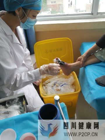 糖尿病烂脚是怎么回事,应该怎么(治疗)办?(图1) 糖尿病烂脚是怎么回事,应该怎么(治疗)办?(图1)