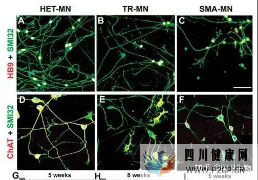 面对70万一针的续命药,干细胞能否给这种疾病带来转...(图7)