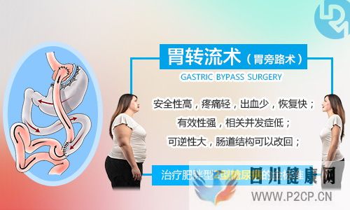 有治疗糖尿病的好方法吗？胃转流手术怎么样？(图1)