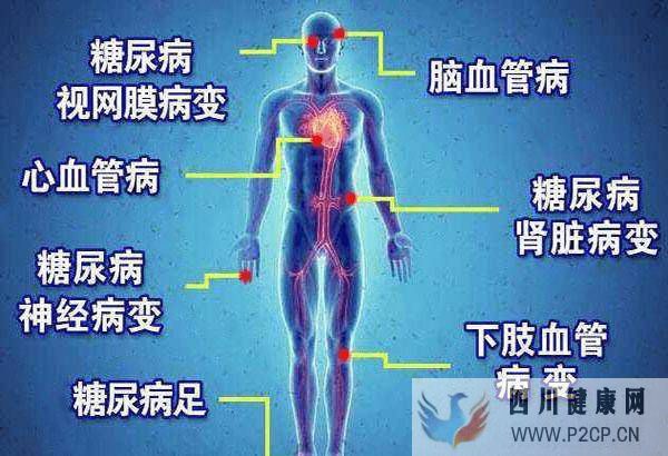 2型糖尿病不治疗，可以自愈，这是真的吗？(图2)