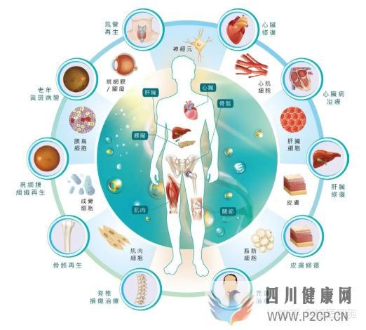 为什么要储存干细胞有什么作用(图2) 为什么要储存干细胞有什么作用(图2)