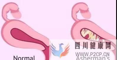 科普干细胞的适应症以及治疗各系统疾病案例分享!(图17) 科普干细胞的适应症以及治疗各系统疾病案例分享!(图17)