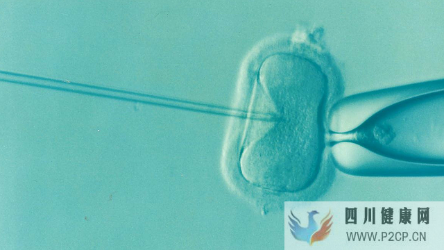 体外受精胚胎移植（IVF-ET）全解-日本干细胞如何治疗不孕不育②(图1)