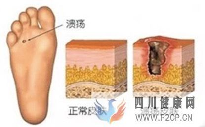 干细胞技术目前治好了哪些病(图4) 干细胞技术目前治好了哪些病(图4)