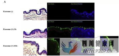 深度!一文读懂间充质干细胞外泌体与疾病的治疗(图20)