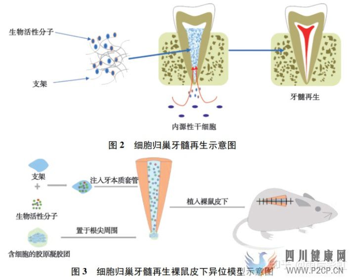 牙髓干细胞应用进展摘取(图3)