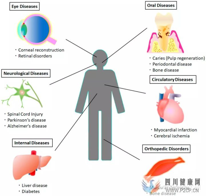 干细胞研究牙髓干细胞的临床潜力和关于神经系统疾...(图3)