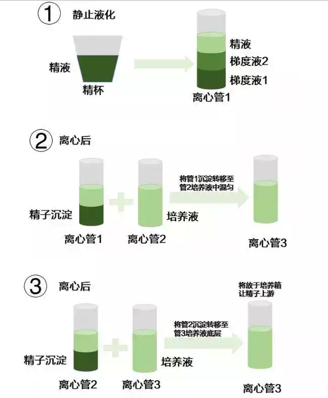 HIV阳性，试管婴儿“洗精”靠谱吗？(图3)