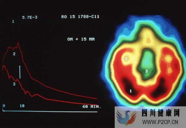 呼吸道病毒感染潮蔓延背后，CT正在被滥用？(图5)