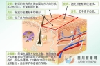 皮肤类型及特点