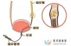 得了肾结石怎么治疗比较好？